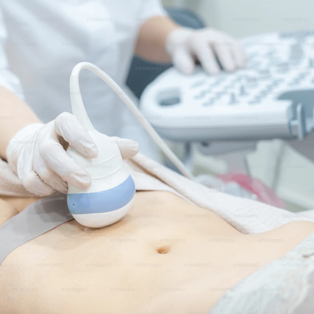 Ultrazvuk abdomena | Poliklinika Mediclarus - Poliklinika Mediclarus