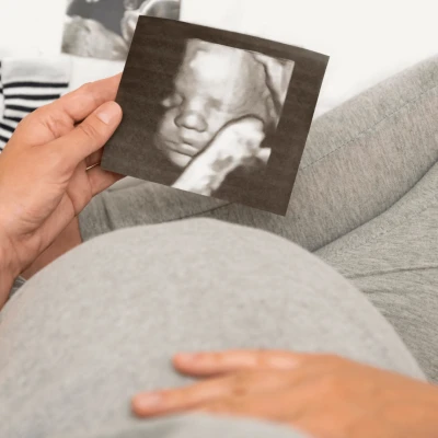 4D ultrazvuk - Poliklinika Mediclarus